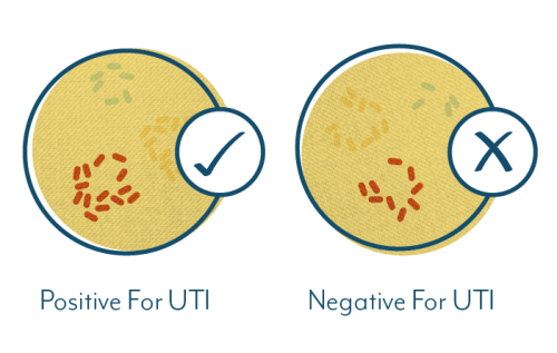 UTI test positive vs negative culture when both samples contain bacteria