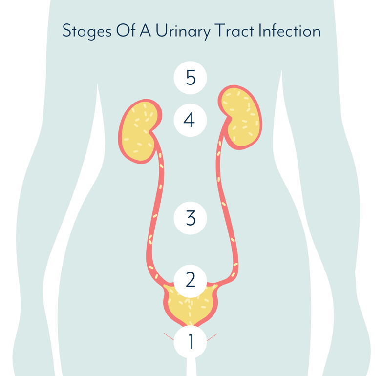 urinary-tract-infection-uti-fastmed