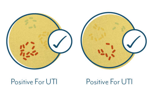 UTI test results positive at all thresholds