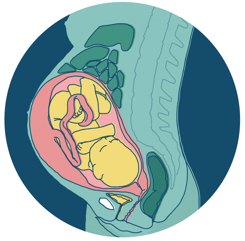 uti presentation in pregnancy