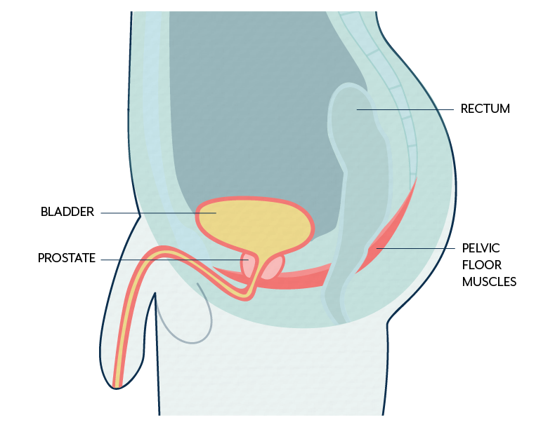 Recurrent Urinary Tract Infections? It May Be Pelvic Floor