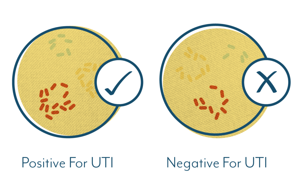 Clean Catch Urine Crucial for an Accurate UTI Test