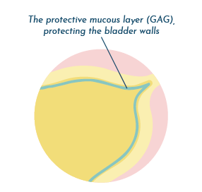 Restoring the GAG layer in UTI